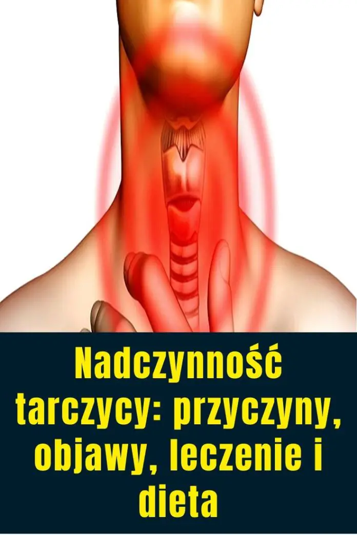 Nadczynność tarczycy przyczyny objawy leczenie i dieta