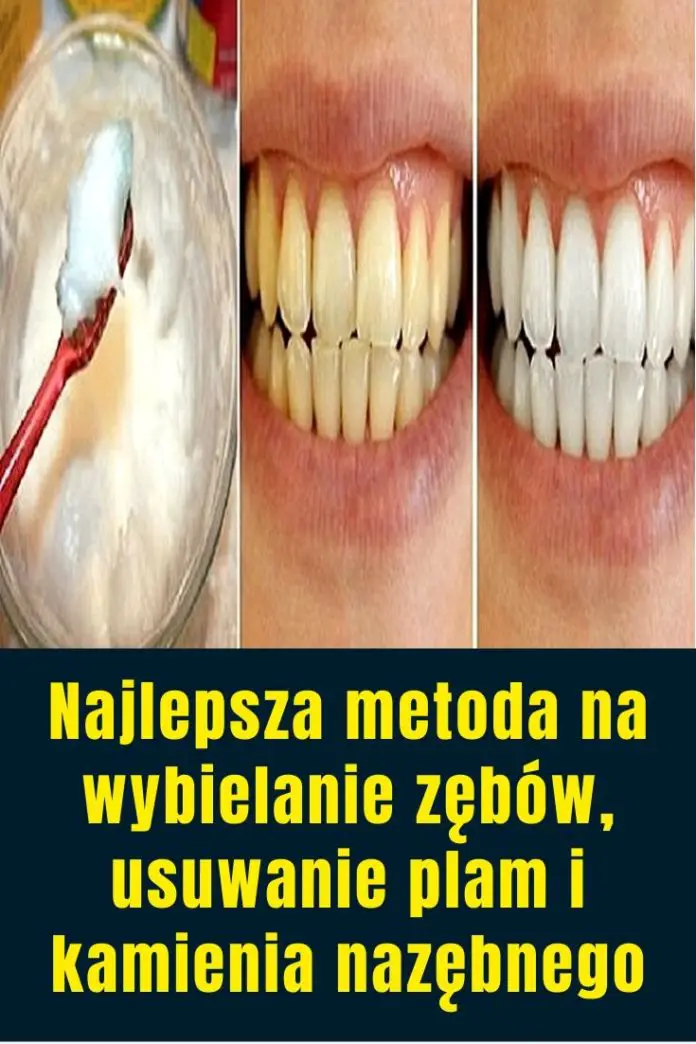 Najlepsza metoda na wybielanie zębów usuwanie plam i kamienia nazębnego