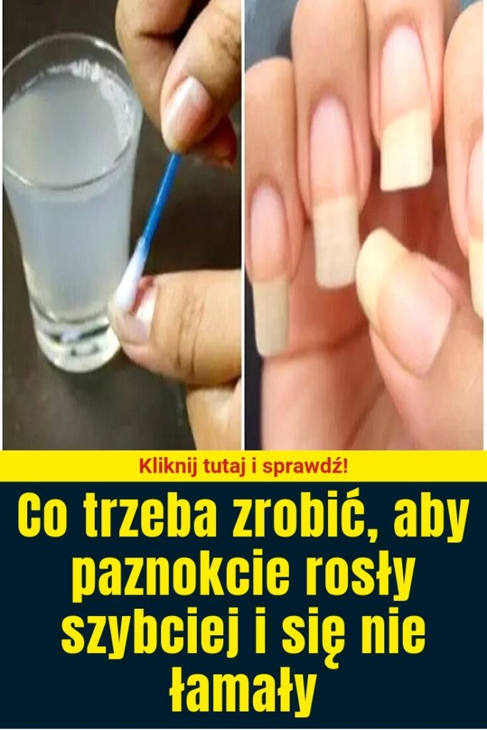 Co Zrobić żeby Bluzka Nie Farbowała Zobacz co trzeba zrobić, aby paznokcie rosły szybciej i się nie łamały