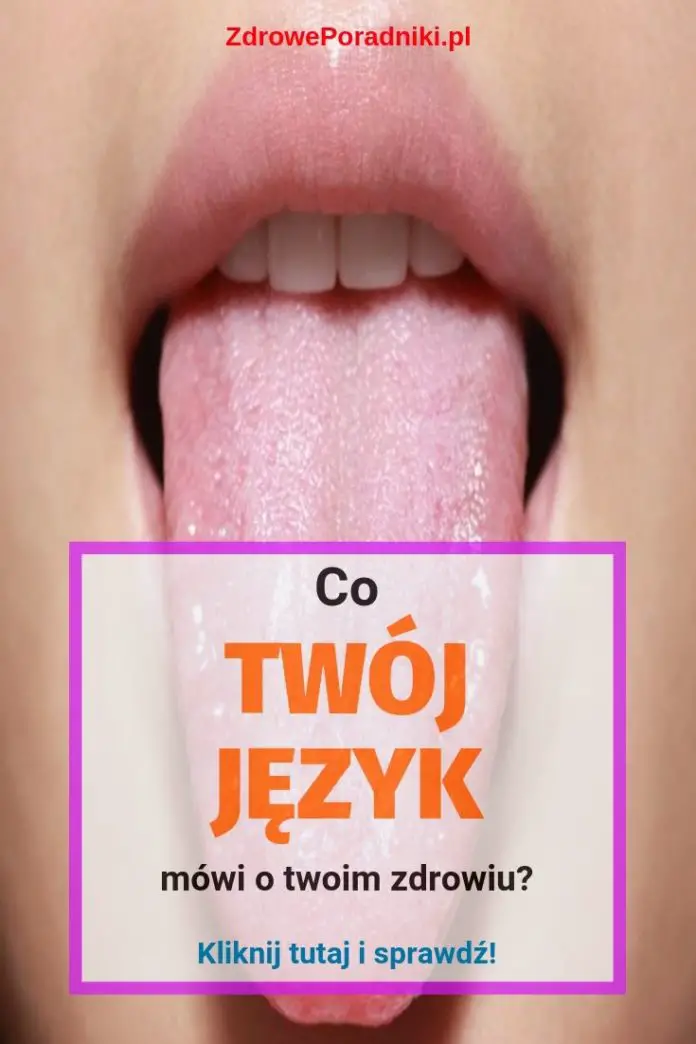 Co Twój Język Mówi O Twoim Zdrowiu 9218