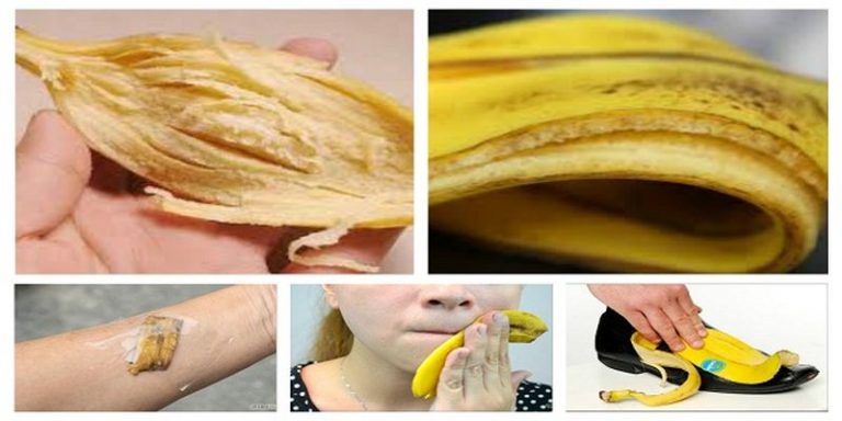 skórka od banana