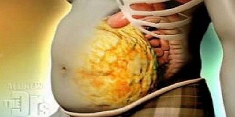 schudnij w 72 godzin