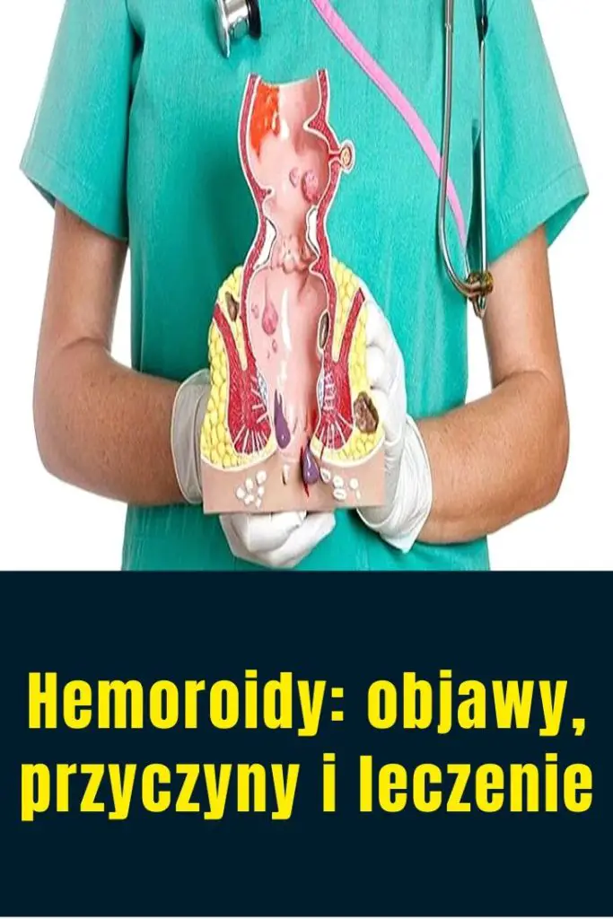 Hemoroidy Objawy Przyczyny I Leczenie 9480