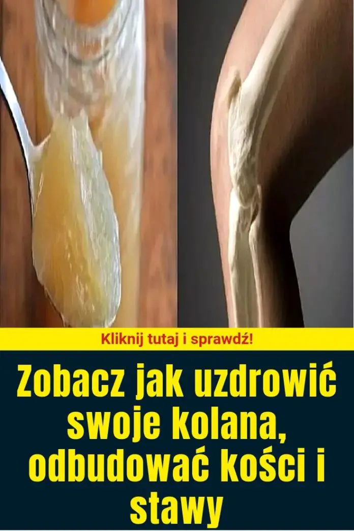 Zobacz Jak Uzdrowić Swoje Kolana, Odbudować Kości I Stawy ...