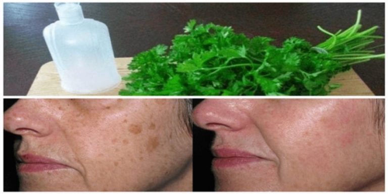 balsam na plamy starcze