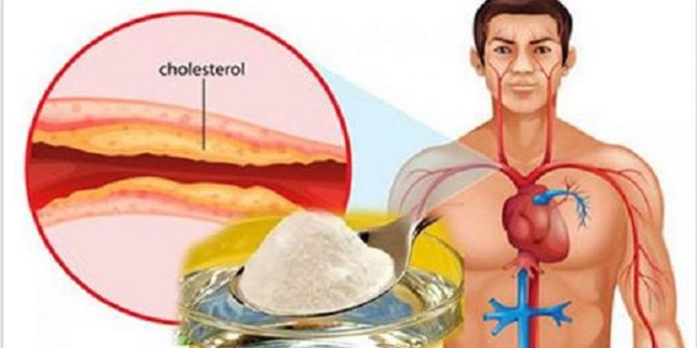 cholesterol