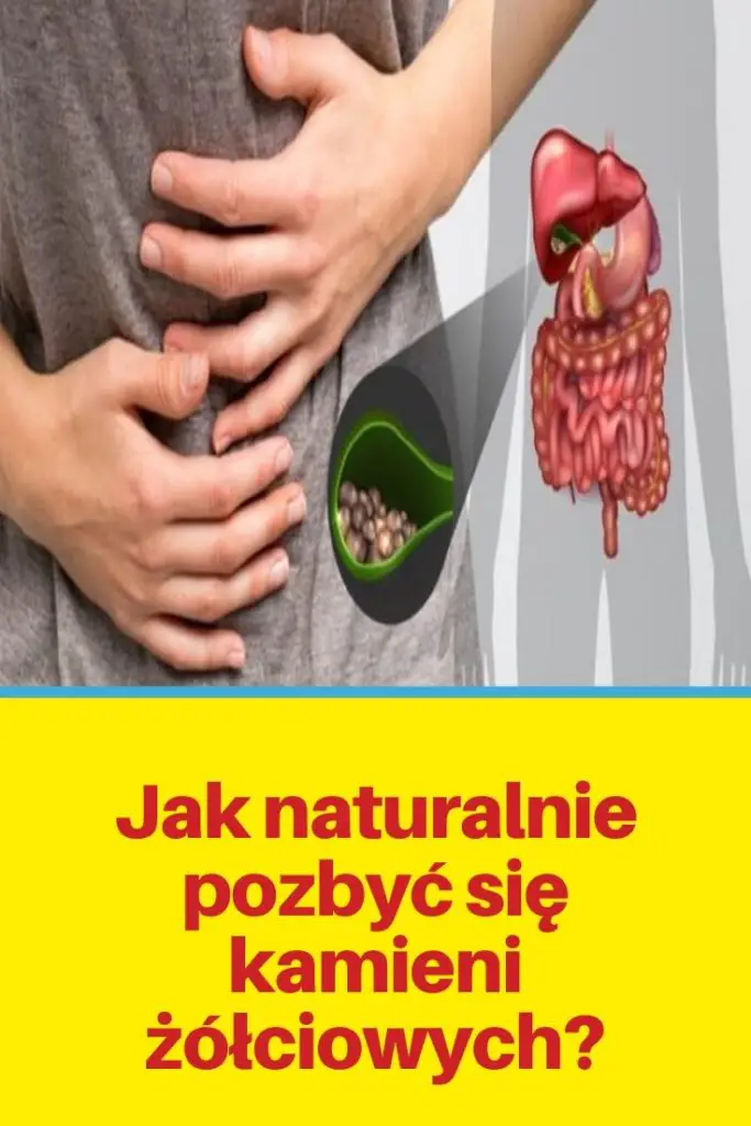 Jak naturalnie pozbyć się kamieni żółciowych?