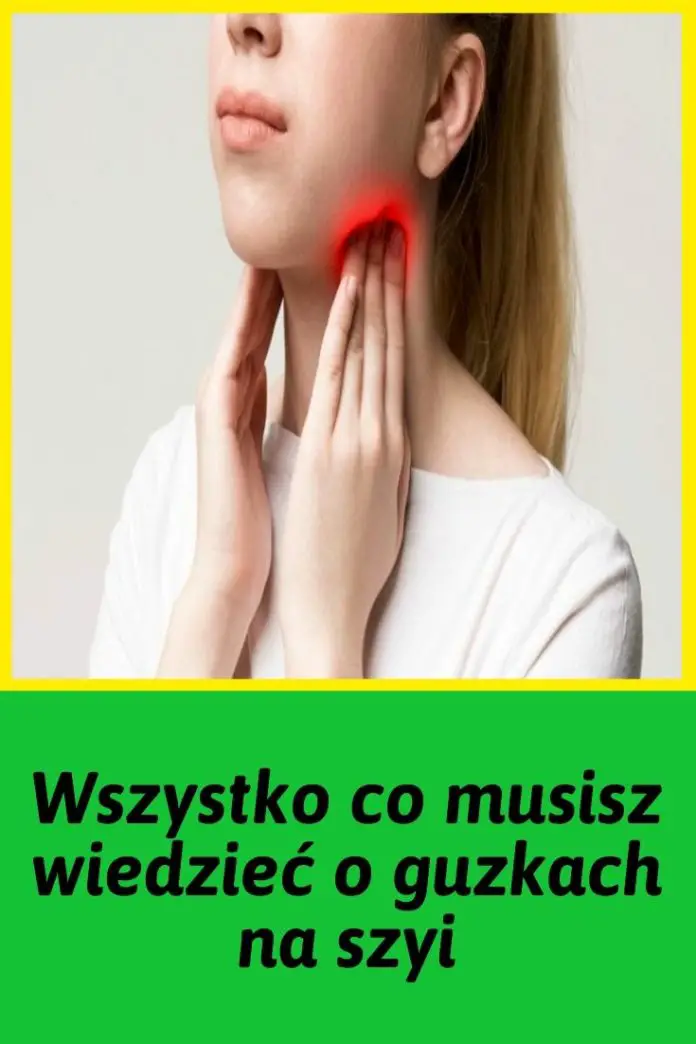 Wszystko Co Musisz Wiedzieć O Guzkach Na Szyi 3320