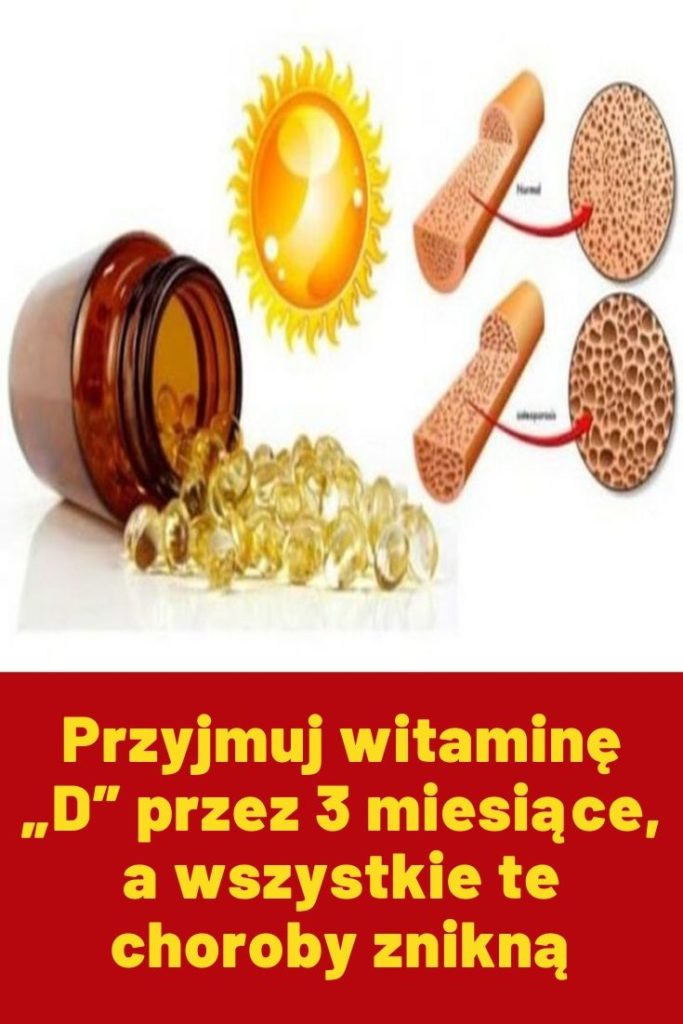 Niedobór Której Witaminy D Prowadzi Do Choroby Zwanej Szkorbutem Przyjmuj witaminę "D" przez 3 miesiące, a wszystkie te choroby znikną