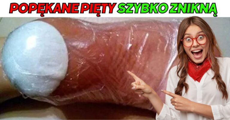 popękane pięty