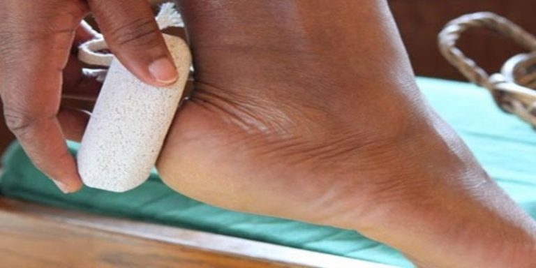 sposob na pekajace piety