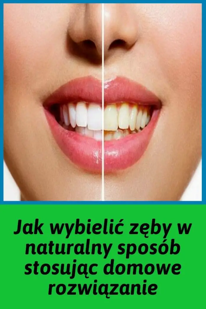 Jak Wybieli Z By W Naturalny Spos B Stosuj C Domowe Rozwi Zanie