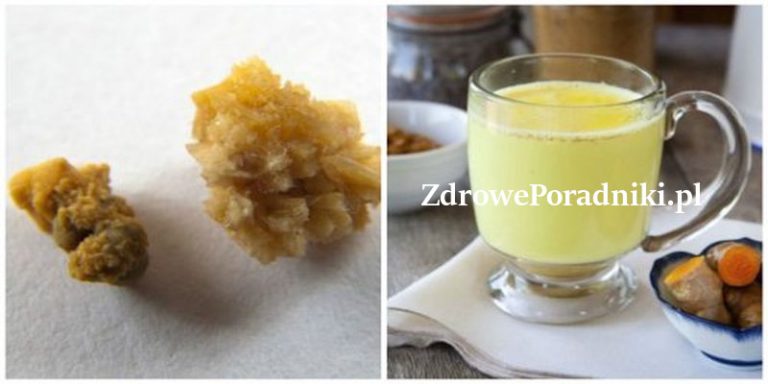 kamienie nerkowe imbir kurkuma