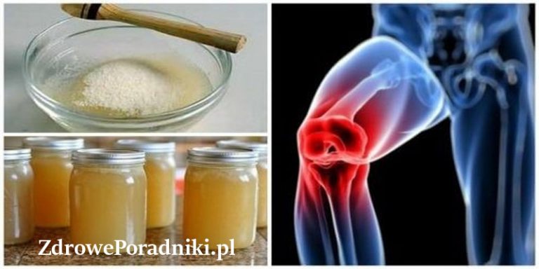 ból stawów 1