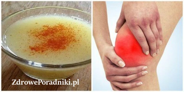 ból stawów 2