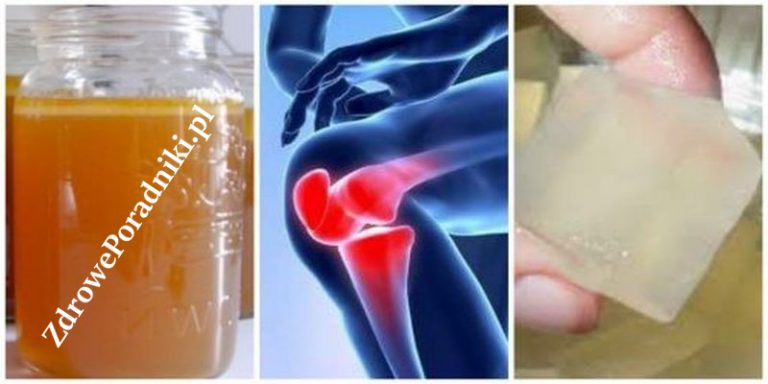 bóle stawów 1