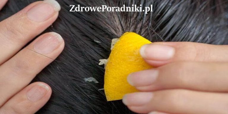 sok z cytryny wypadanie włosów