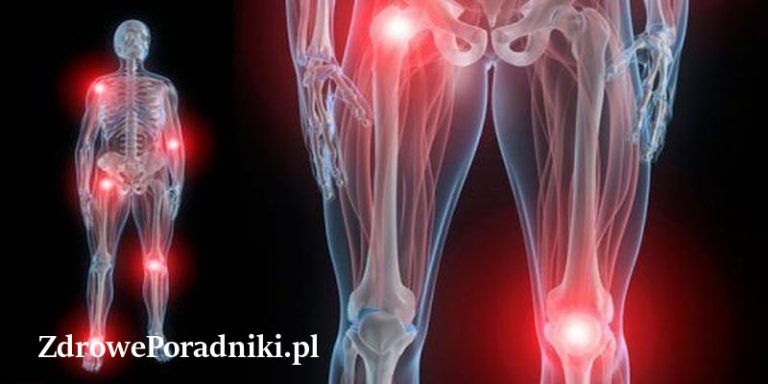 bóle stawów