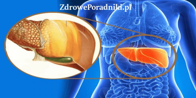 stłuczenie wątroby