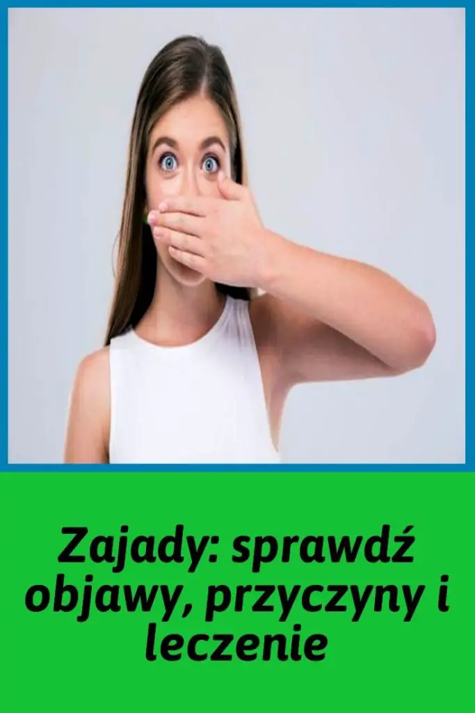 Zajady Sprawdź Objawy Przyczyny I Leczenie 6648