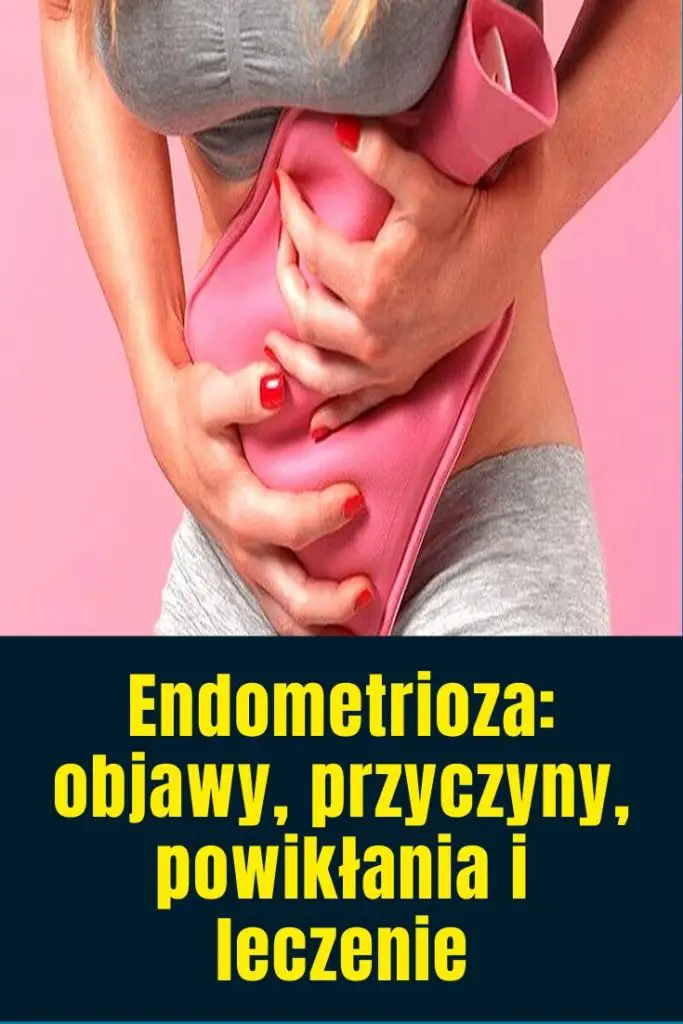 Endometrioza Objawy Przyczyny Powikłania I Leczenie 3453