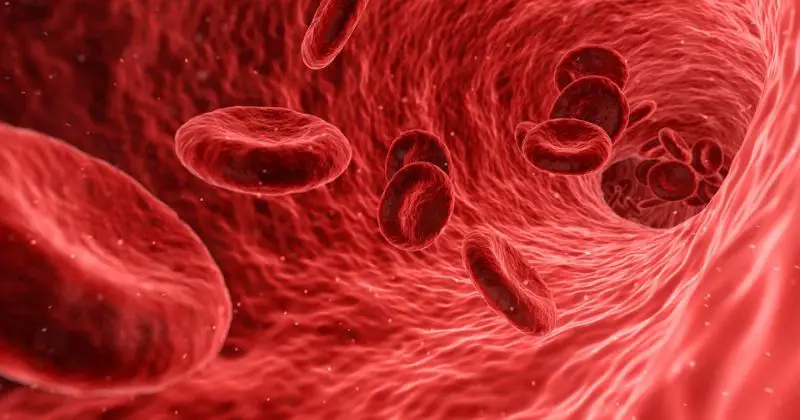 Anemia: przyczyny, objawy i leczenie