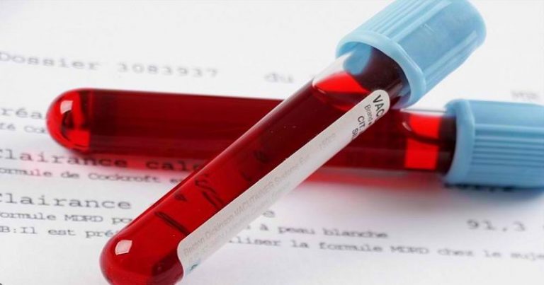 Anemia: przyczyny, objawy i leczenie