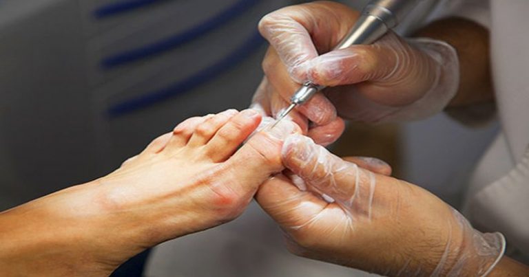 Grzybica paznokci: informacje, leczenie, objawy oraz leki