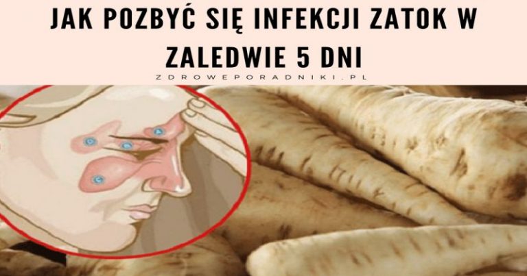 Jak pozbyć się infekcji zatok w 5 dni