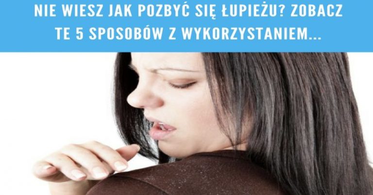 Nie wiesz jak pozbyć się łupieżu Zobacz te  sposobów z wykorzystaniem