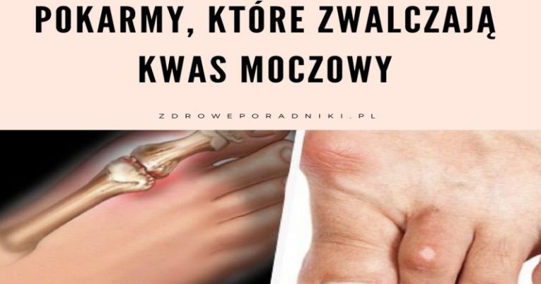 Pokarmy które zwalczają kwas moczowy