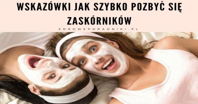 jak szybko pozbyć się zaskórników