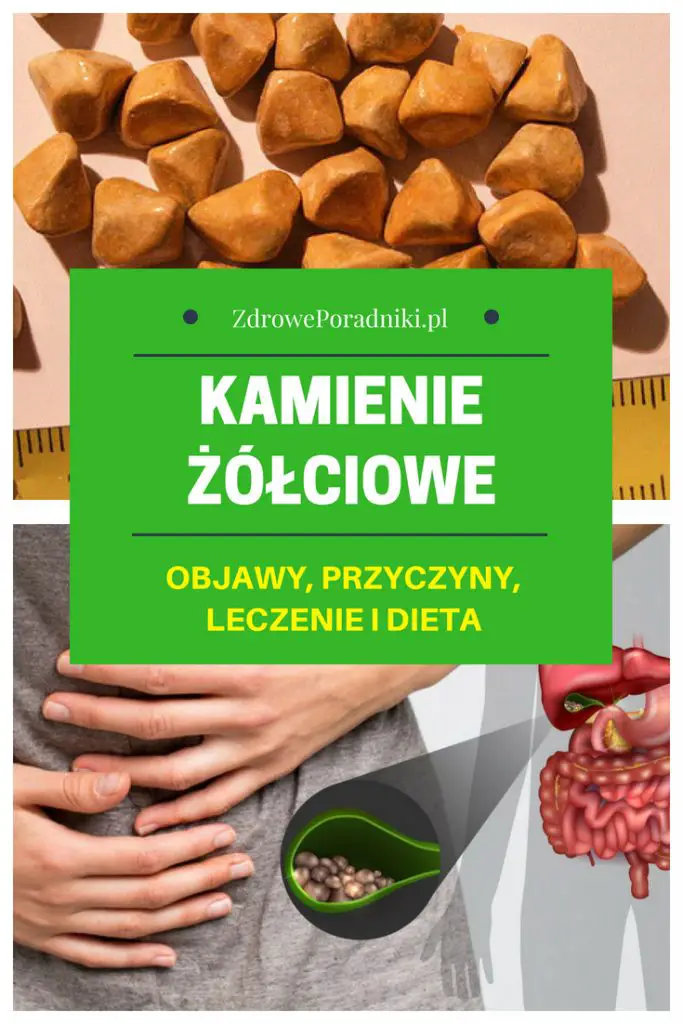 Kamienie żółciowe objawy, przyczyny, leczenie i dieta