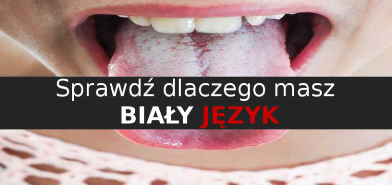 Biały nalot na języku