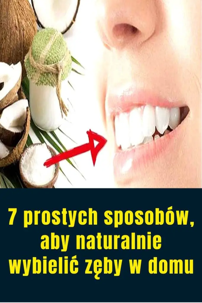 7 Prostych Sposobów Aby Naturalnie Wybielić Zęby W Domu 4099