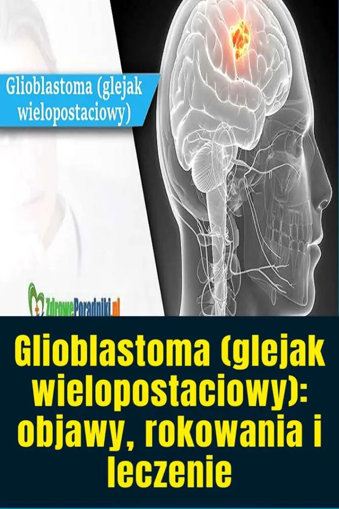 Glioblastoma Glejak Wielopostaciowy Objawy Rokowania I Leczenie