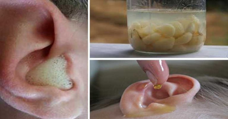 domowe sposoby na ból ucha