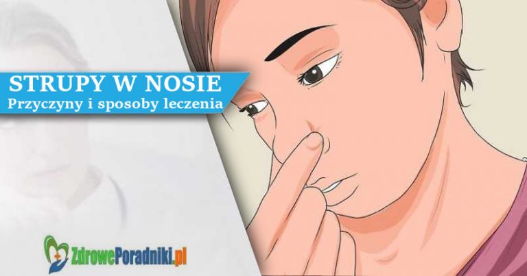 strupy w nosie