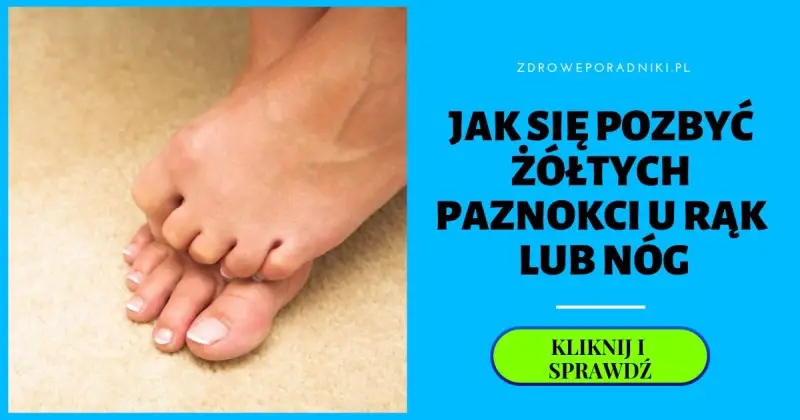 Co Powoduje Zolte Paznokcie U Rak Lub Stop Jak Sie Ich Pozbyc