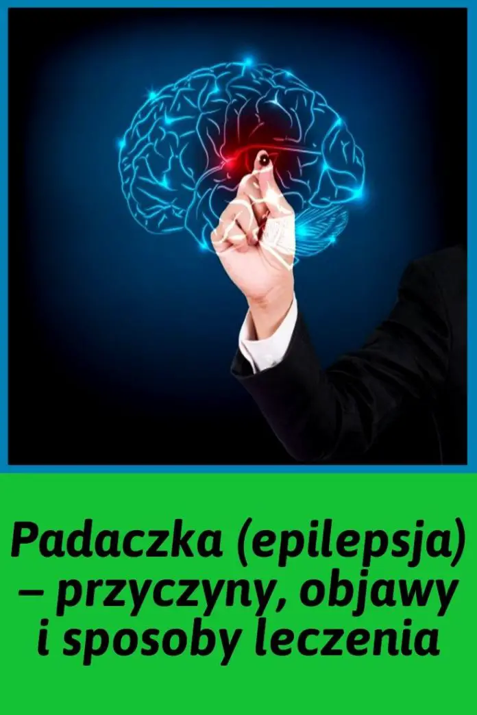 Padaczka Epilepsja Objawy Przyczyny I Leczenie Czy Mo Na The Best