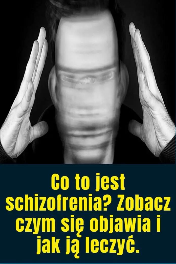 Co To Jest Schizofrenia Zobacz Czym Się Objawia I Jak Ją Leczyć 5231