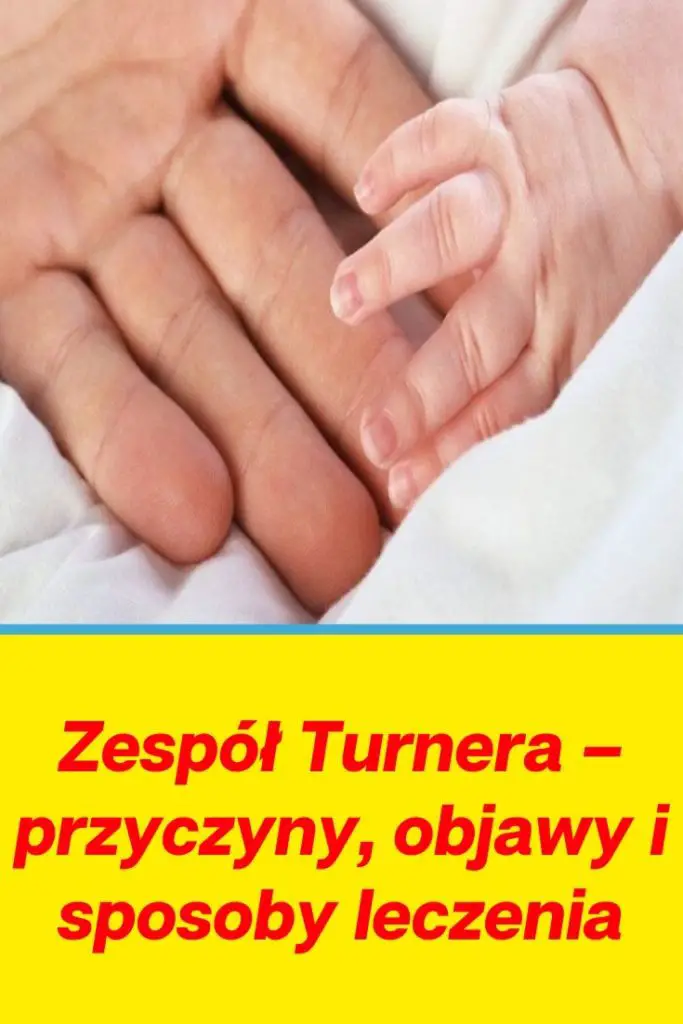 Zespół Turnera Przyczyny Objawy I Sposoby Leczenia 9479