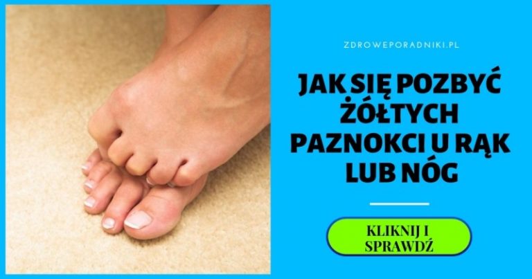 żółte paznokcie