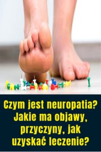 Czym Jest Neuropatia? Jakie Ma Objawy, Przyczyny, Jak Uzyskać Leczenie?