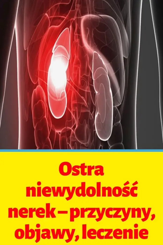 Ostra niewydolność nerek przyczyny, objawy, leczenie