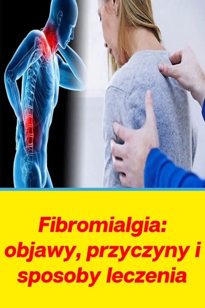 Fibromialgia Objawy Przyczyny I Sposoby Leczenia Zdrowe Poradniki 9617