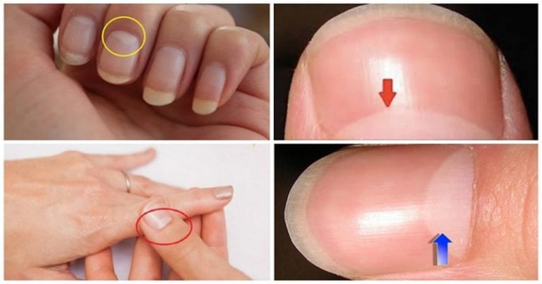 Czy wiesz, co kształt półksiężyca na twoich paznokciach oznacza? Będziesz zaskoczony!