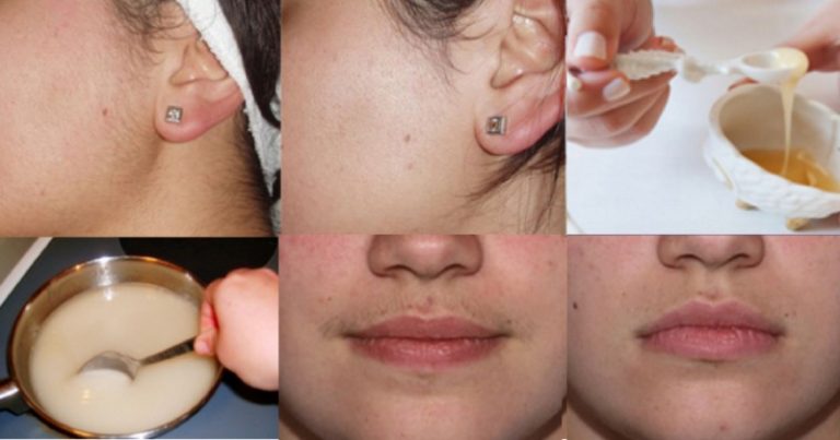 usun włosy z twarzy