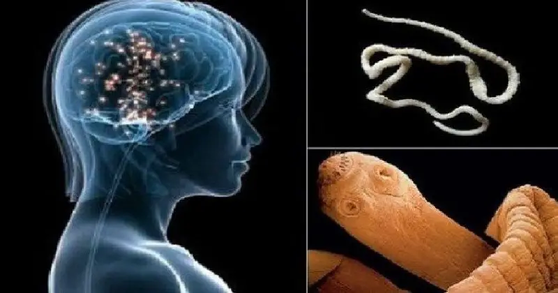 robaki w mozgu