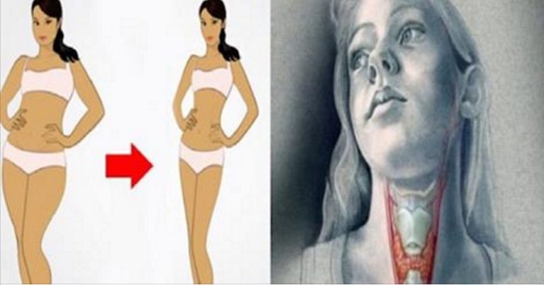 tarczyca i odchudzanie